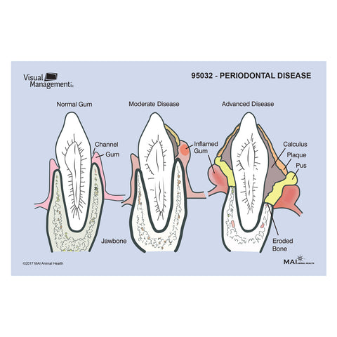 EduPad™ - Periodontal Disease